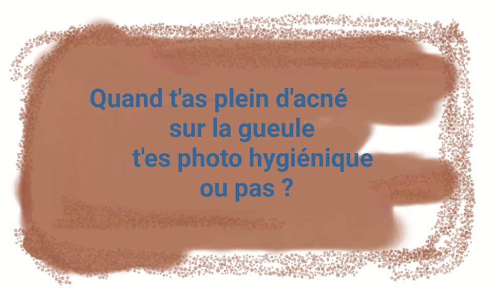 Boutons acné